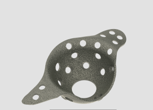 Acetabular cage